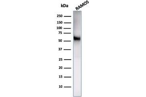 Western Blot Analysis of Ramos cell lysate using CD86 Rabbit Recombinant Monoclonal Antibody (C86/2160R). (Recombinant CD86 antibody)