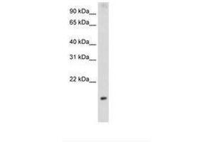 Image no. 2 for anti-Protein Phosphatase 1, Regulatory Subunit 8 (PPP1R8) (AA 71-120) antibody (ABIN203009) (PPP1R8 antibody  (AA 71-120))