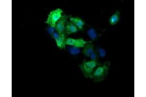 Image no. 2 for anti-Mitogen-Activated Protein Kinase Kinase 3 (MAP2K3) antibody (ABIN1499405) (MAP2K3 antibody)