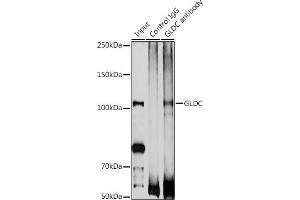 Immunoprecipitation analysis of 200 μg extracts of DU145 cells using 3 μg GLDC antibody (ABIN6132011, ABIN6141119, ABIN6141120 and ABIN6225260). (GLDC antibody  (AA 36-290))