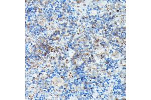 Immunohistochemistry of paraffin-embedded mouse spleen using Phospho-VASP-S239 Rabbit pAb (ABIN3019748, ABIN3019749, ABIN3019750, ABIN1682137 and ABIN1682138) at dilution of 1:50 (40x lens). (VASP antibody  (pSer239))