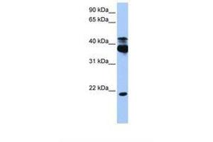 Image no. 1 for anti-serine/threonine Kinase 38 (STK38) (AA 368-417) antibody (ABIN6738495) (STK38 antibody  (AA 368-417))
