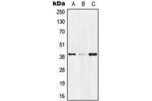 Western blot analysis of GPR174 expression in Jurkat (A), mouse kidney (B), rat kidney (C) whole cell lysates.