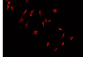 ABIN6266508 staining A549  cells by IF/ICC. (Claudin 2 antibody  (C-Term))