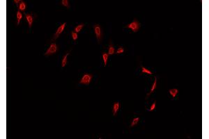 ABIN6266508 staining A549  cells by IF/ICC. (Claudin 2 antibody  (C-Term))