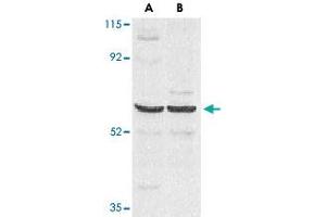 Western blot analysis of CARD9 expression in human MDA-MB-361 (A) and PC-3 (B) cell lysate with CARD9 polyclonal antibody  at 2. (CARD9 antibody  (AA 521-536))