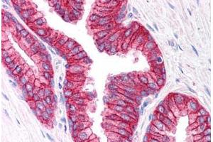 Human Prostate (formalin-fixed, paraffin-embedded) stained with ABCC4 antibody ABIN296628 at 2. (ABCC4 antibody  (AA 1312-1325))