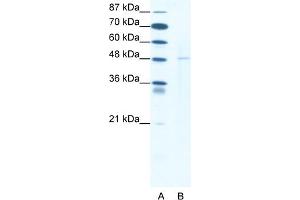 WB Suggested Anti-DEK Antibody Titration:  1. (DEK antibody  (N-Term))