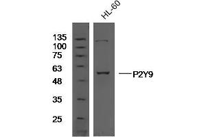 Human HL60 cell lysates probed with Rabbit Anti-P2Y9 Polyclonal Antibody, Unconjugated  at 1:300 overnight at 4˚C. (LPAR4 antibody  (AA 175-270))