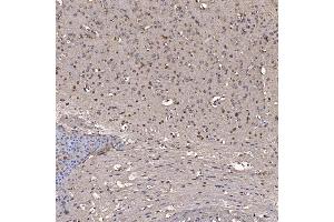 IHC analysis of NOB1 using anti-NOB1 antibody (ABIN7599344). (NOB1 antibody  (AA 1-389))