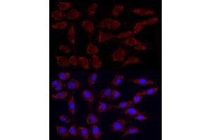 Immunofluorescence analysis of NIH/3T3 using Phospho-PDH-S293 Rabbit mAb (ABIN7269768) at dilution of 1:100 (40x lens). (PDHA1 antibody  (pSer293))