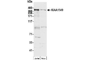 Western Blotting (WB) image for anti-KIAA1549 (KIAA1549) (AA 1450-1500) antibody (ABIN7452824)