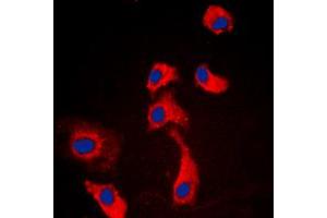 Immunofluorescent analysis of GPR116 staining in HEK293T cells.