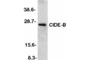 Image no. 1 for anti-Cell Death-Inducing DFFA-Like Effector B (CIDEB) (AA 204-219) antibody (ABIN201953) (CIDEB antibody  (AA 204-219))