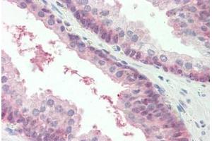 MARCH2 antibody  (AA 146-195)