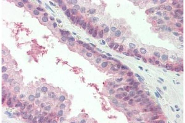 MARCH2 antibody  (AA 146-195)