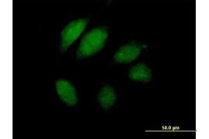 Immunofluorescence of purified MaxPab antibody to JTV1 on HeLa cell.