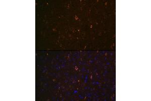 Immunofluorescence analysis of mouse brain using  Rabbit pAb (ABIN7265728) at dilution of 1:100 (40x lens). (ABCA2 antibody  (AA 2307-2466))
