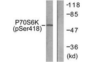 Western blot analysis of extracts from HT29 cells treated with serum 20% 15', using p70 S6 Kinase (Phospho-Ser418) Antibody. (RPS6KB1 antibody  (pSer418))