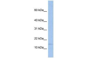 TRAPPC2 antibody used at 0. (TRAPPC2 antibody  (Middle Region))