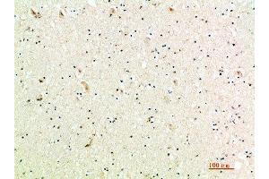 Immunohistochemical analysis of paraffin-embedded human-brain, antibody was diluted at 1:200 (CXCL9 antibody  (AA 90-125))
