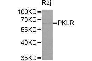 Western Blotting (WB) image for anti-Pyruvate Kinase, Liver and RBC (PKLR) antibody (ABIN1874148) (PKLR antibody)