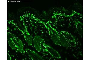Immunohistochemistry analysis using Mouse Anti-Acetylated Lysine Monoclonal Antibody, Clone 7F8 (ABIN361802 and ABIN361803). (Lysine (lys) (acetylated) antibody)