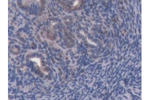 DAB staining on IHC-P; Samples: Mouse Uterus Tissue (ABCB8 antibody  (AA 468-717))