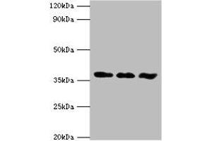 Western blot All lanes: ACVR1 antibody at 6 μg/mL Lane 1: A549 whole cell lysate Lane 2: HepG2 whole cell lysate Lane 3: Mouse gonad tissue Secondary Goat polyclonal to rabbit IgG at 1/10000 dilution Predicted band size: 39 kDa Observed band size: 39 kDa (ACVR1 antibody  (AA 20-125))