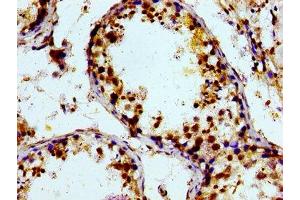 Immunohistochemistry of paraffin-embedded human testis tissue using ABIN7164870 at dilution of 1:100 (PTGR2 antibody  (AA 206-282))