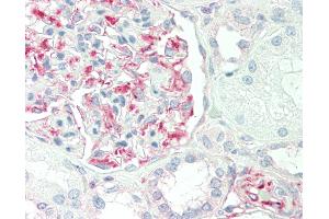 Human Kidney: Formalin-Fixed, Paraffin-Embedded (FFPE) (CD34 antibody  (AA 185-214))