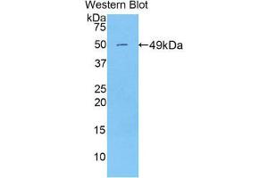 Western Blotting (WB) image for anti-Peroxiredoxin 3 (PRDX3) (AA 64-257) antibody (ABIN1860307) (Peroxiredoxin 3 antibody  (AA 64-257))