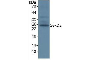 Detection of TIGIT in Mouse Spleen Tissue using Polyclonal Antibody to T-Cell Immunoreceptor With Ig And ITIM Domains Protein (TIGIT) (TIGIT antibody  (AA 28-246))