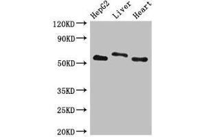 Western Blot Positive WB detected in: HepG2 whole cell lysate, Rat liver tissue, Mouse heart tissue All lanes: SLC13A5 antibody at 2. (SLC13A5 antibody  (AA 156-204))