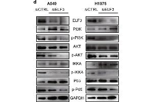 ELF3 can be induced by IL1B and promotes tumor growth through PI3K/AKT/NF-κB pathway. (ELF3 antibody  (AA 1-280))