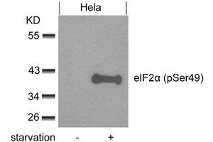 Western blot analysis of extracts from Hela cells untreated or treated with starvation using eIF2a(phospho-Ser49) Antibody. (EIF2S1 antibody  (pSer49))