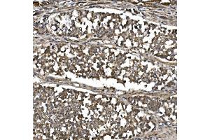 IHC analysis of MitoNEET/CISD1 using anti-MitoNEET/CISD1 antibody (ABIN7601089). (CISD1 antibody  (AA 28-93))