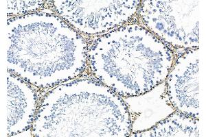 ABIN6259689 and ABIN6278305 at 1/100 staining Rat testis tissue by IHC-P.