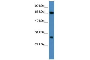 KBTBD8 antibody (70R-10021) used at 0. (KBTBD8 antibody  (N-Term))