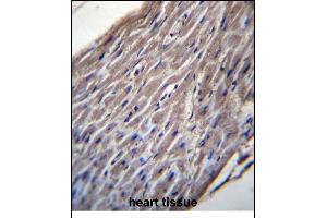 BVES Antibody (C-term) (ABIN656934 and ABIN2846126) immunohistochemistry analysis in formalin fixed and paraffin embedded human heart tissue followed by peroxidase conjugation of the secondary antibody and DAB staining.