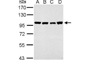 Western Blotting (WB) image for anti-CSE1 Chromosome Segregation 1-Like (CSE1L) (Center) antibody (ABIN2855534)
