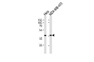 Western blot analysis of lysates from Hela, MDA-MB-453 cell line (from left to right), using Calponin-1 Antibody (N-term) (ABIN390766 and ABIN2841024). (CNN1 antibody  (N-Term))