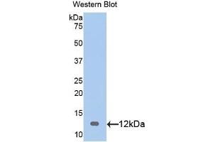 Detection of Recombinant S100, Rat using Polyclonal Antibody to S100 Calcium Binding Protein (S100) (S100 Protein (S100) (AA 1-94) antibody)