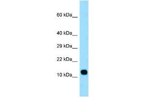 WB Suggested Anti-LCE3C Antibody Titration: 1. (LCE3C antibody  (Middle Region))