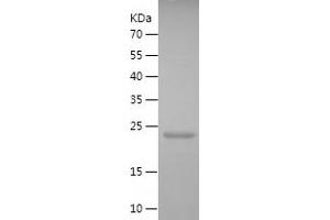 Western Blotting (WB) image for Caspase 4, Apoptosis-Related Cysteine Peptidase (CASP4) (AA 80-270) protein (His tag) (ABIN7283837) (Caspase 4 Protein (AA 80-270) (His tag))