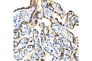 IHC analysis of KAT3B/P300/EP300 using anti-KAT3B/P300/EP300 antibody (ABIN7603064).