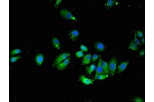 Immunofluorescent analysis of HepG2 cells using ABIN7175463 at dilution of 1:100 and Alexa Fluor 488-congugated AffiniPure Goat Anti-Rabbit IgG(H+L) (VTI1A antibody  (AA 1-175))