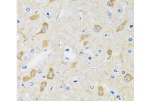 Immunohistochemistry of paraffin-embedded Mouse brain using HSPH1 Polyclonal Antibody at dilution of 1:100 (40x lens). (HSPH1 antibody)