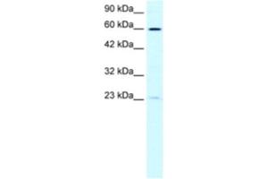 Western Blotting (WB) image for anti-Suppressor of Ty 3 Homolog (SUPT3H) antibody (ABIN2460155) (SUPT3H/SPT3 antibody)