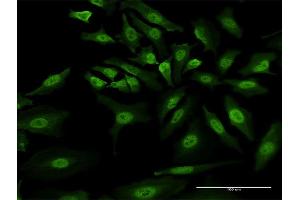 Immunofluorescence (IF) image for anti-Zinc Finger Protein GLI1 (GLI1) (AA 401-500) antibody (ABIN1326972)